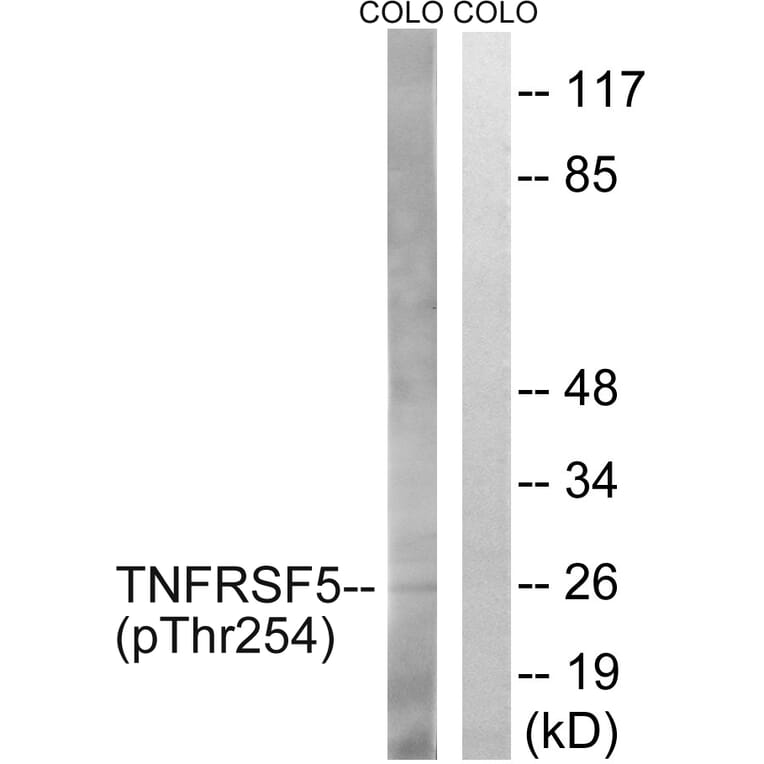 Western Blot - Anti-TNFRSF5 (phospho Thr254) Antibody (A1129) - Antibodies.com