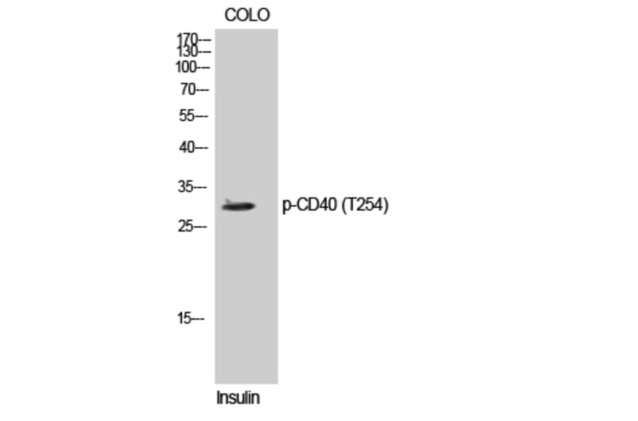 Western Blot - Anti-TNFRSF5 (phospho Thr254) Antibody (A1129) - Antibodies.com