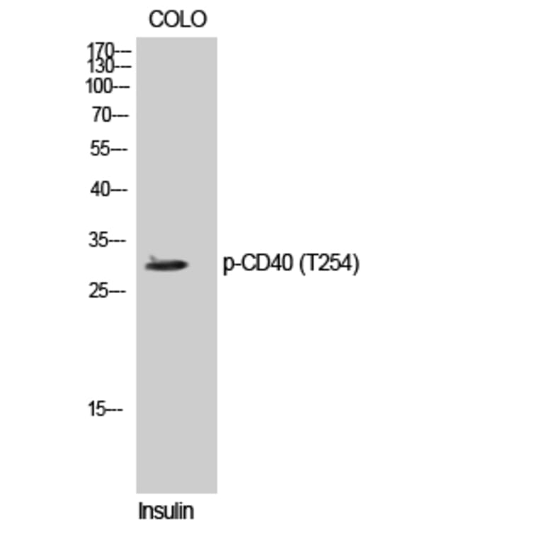 Western Blot - Anti-TNFRSF5 (phospho Thr254) Antibody (A1129) - Antibodies.com