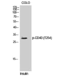 Western Blot - Anti-TNFRSF5 (phospho Thr254) Antibody (A1129) - Antibodies.com