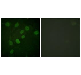 Immunofluorescence - Anti-DNA-PK (phospho Thr2638) Antibody (A0908) - Antibodies.com