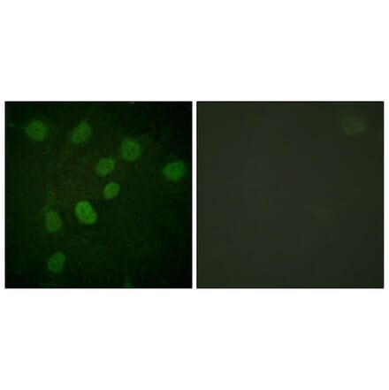 Immunofluorescence - Anti-DNA-PK (phospho Thr2638) Antibody (A0908) - Antibodies.com