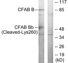 Western Blot - Anti-CFAB Bb (cleaved Lys260) Antibody (L0234) - Antibodies.com