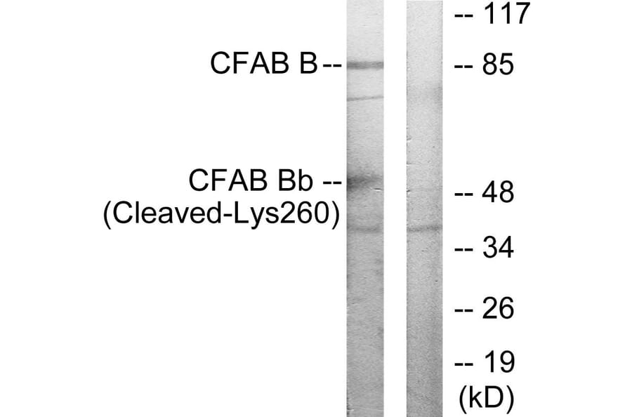 Western Blot - Anti-CFAB Bb (cleaved Lys260) Antibody (L0234) - Antibodies.com
