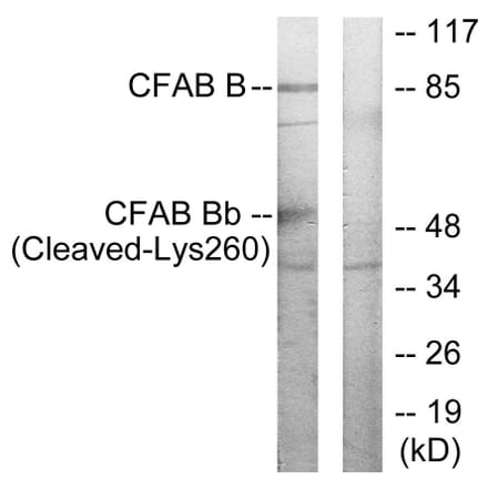 Western Blot - Anti-CFAB Bb (cleaved Lys260) Antibody (L0234) - Antibodies.com