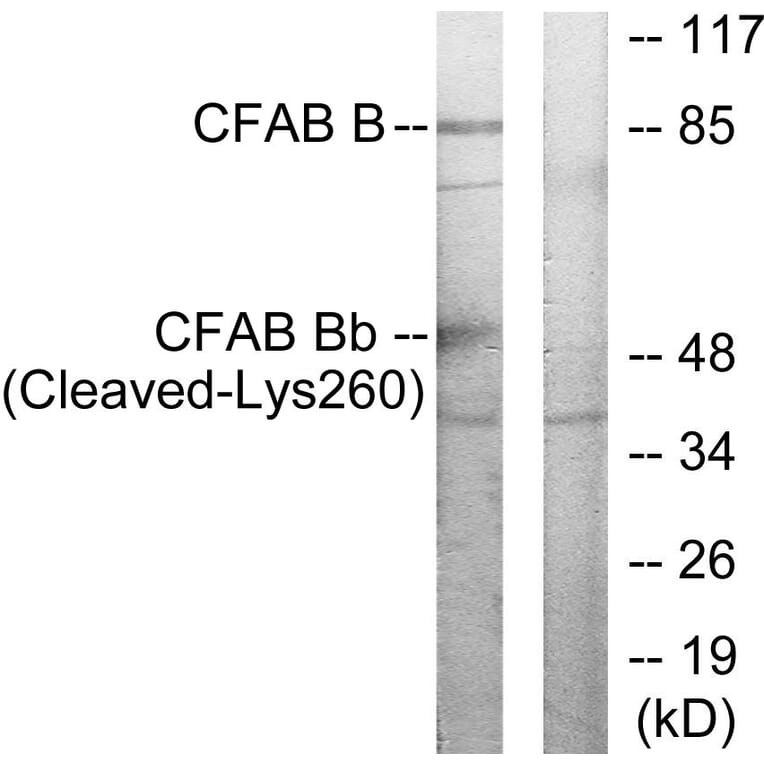 Western Blot - Anti-CFAB Bb (cleaved Lys260) Antibody (L0234) - Antibodies.com