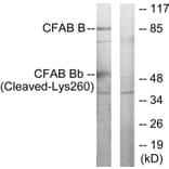 Western Blot - Anti-CFAB Bb (cleaved Lys260) Antibody (L0234) - Antibodies.com