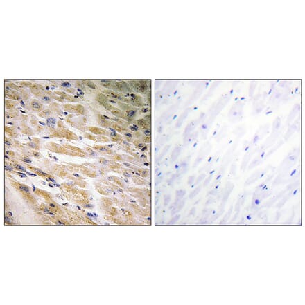 Immunohistochemistry - Anti-MEF2C (phospho Ser387) Antibody (A0509) - Antibodies.com