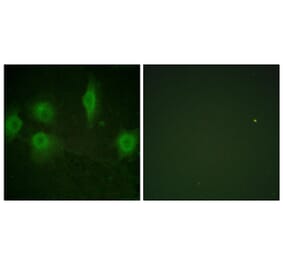 Immunofluorescence - Anti-IL-9R (phospho Ser519) Antibody (A1067) - Antibodies.com