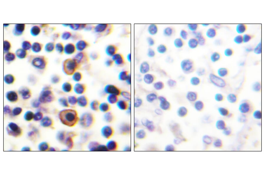 Immunohistochemistry - Anti-IL-9R (phospho Ser519) Antibody (A1067) - Antibodies.com