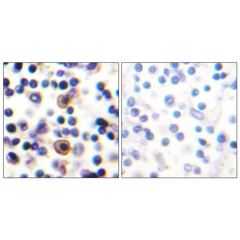 Immunohistochemistry - Anti-IL-9R (phospho Ser519) Antibody (A1067) - Antibodies.com