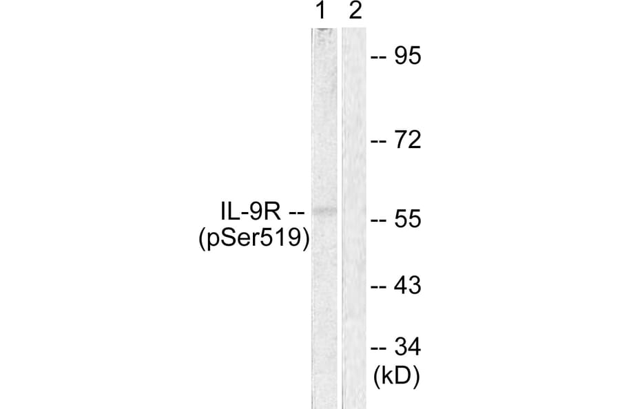 Western Blot - Anti-IL-9R (phospho Ser519) Antibody (A1067) - Antibodies.com