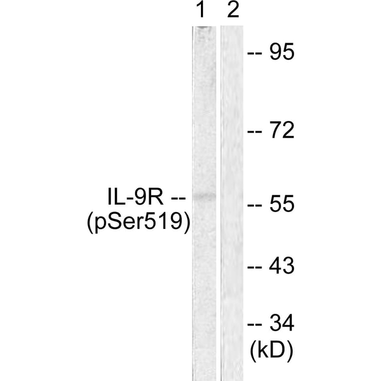 Western Blot - Anti-IL-9R (phospho Ser519) Antibody (A1067) - Antibodies.com