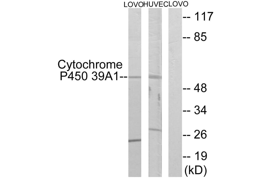 Western Blot - Anti-Cytochrome P450 39A1 Antibody (C12275) - Antibodies.com