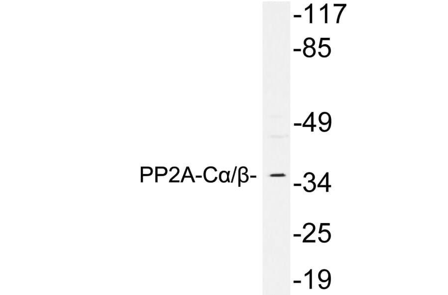 Western Blot - Anti-PP2A C alpha + beta Antibody (R12-2317) - Antibodies.com