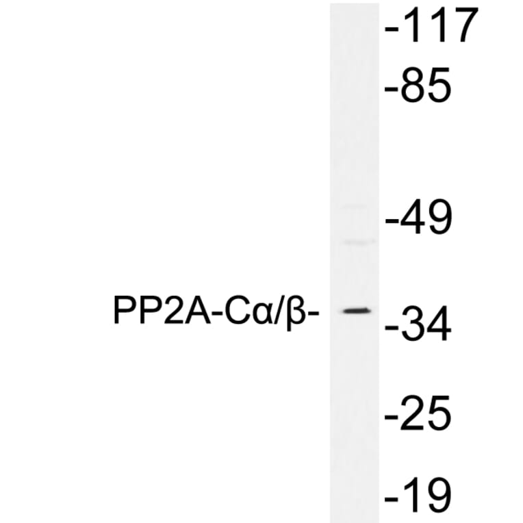 Western Blot - Anti-PP2A C alpha + beta Antibody (R12-2317) - Antibodies.com
