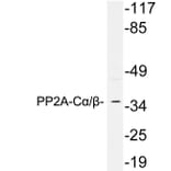 Western Blot - Anti-PP2A C alpha + beta Antibody (R12-2317) - Antibodies.com