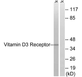 Western Blot - Anti-Vitamin D3 Receptor Antibody (B8205) - Antibodies.com