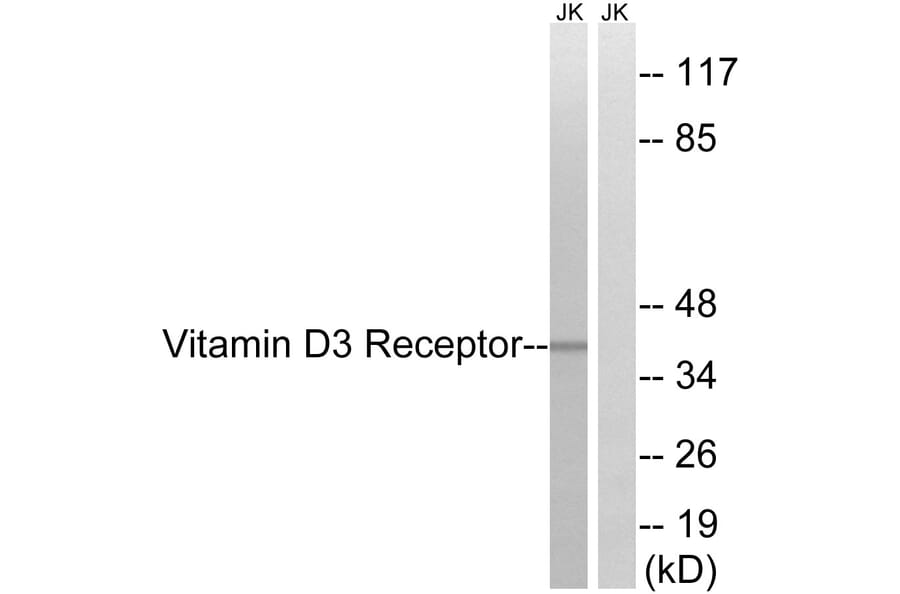 Western Blot - Anti-Vitamin D3 Receptor Antibody (B8205) - Antibodies.com