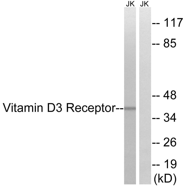 Western Blot - Anti-Vitamin D3 Receptor Antibody (B8205) - Antibodies.com