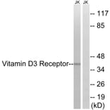 Western Blot - Anti-Vitamin D3 Receptor Antibody (B8205) - Antibodies.com