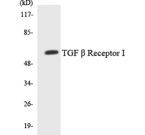 Western Blot - Anti-TGF beta Receptor I Antibody (R12-3618) - Antibodies.com