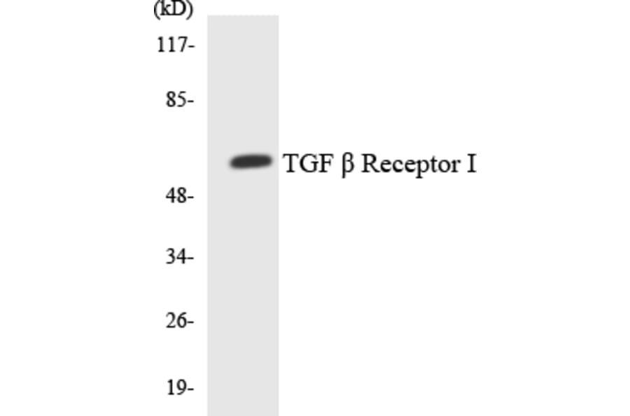 Western Blot - Anti-TGF beta Receptor I Antibody (R12-3618) - Antibodies.com