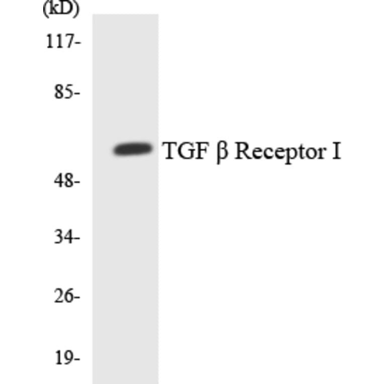 Western Blot - Anti-TGF beta Receptor I Antibody (R12-3618) - Antibodies.com