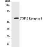 Western Blot - Anti-TGF beta Receptor I Antibody (R12-3618) - Antibodies.com