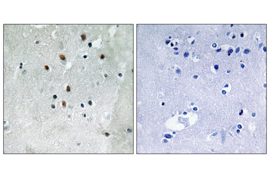 Immunohistochemistry - Anti-SRF (phospho Ser77) Antibody (A8062) - Antibodies.com