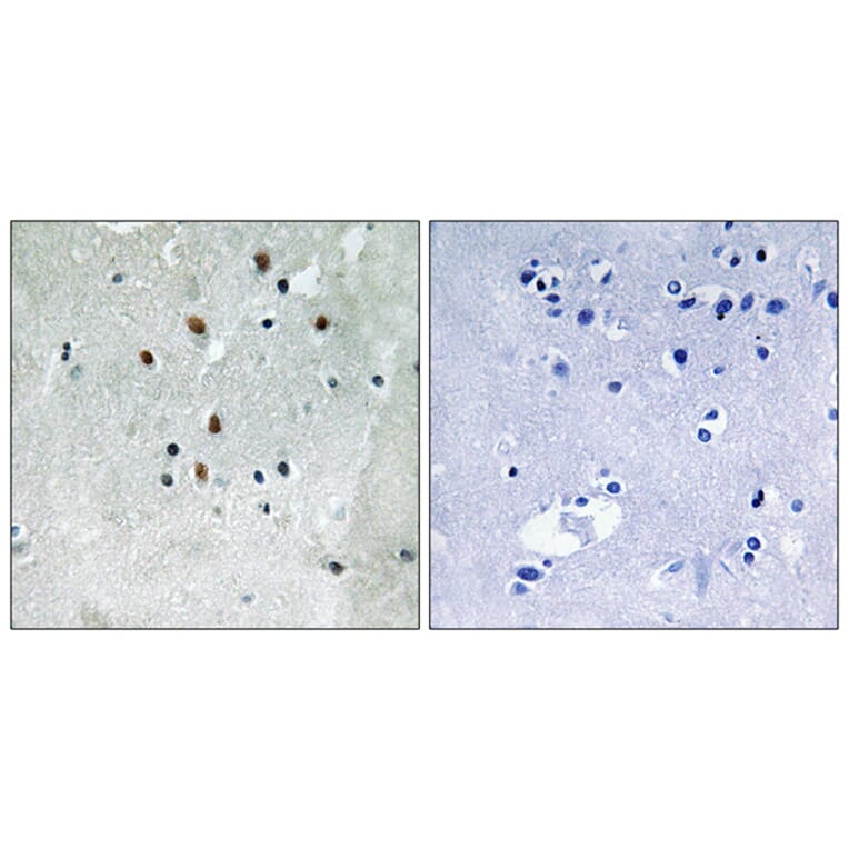 Immunohistochemistry - Anti-SRF (phospho Ser77) Antibody (A8062) - Antibodies.com