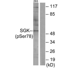 Western Blot - Anti-SGK (phospho Ser78) Antibody (A0735) - Antibodies.com