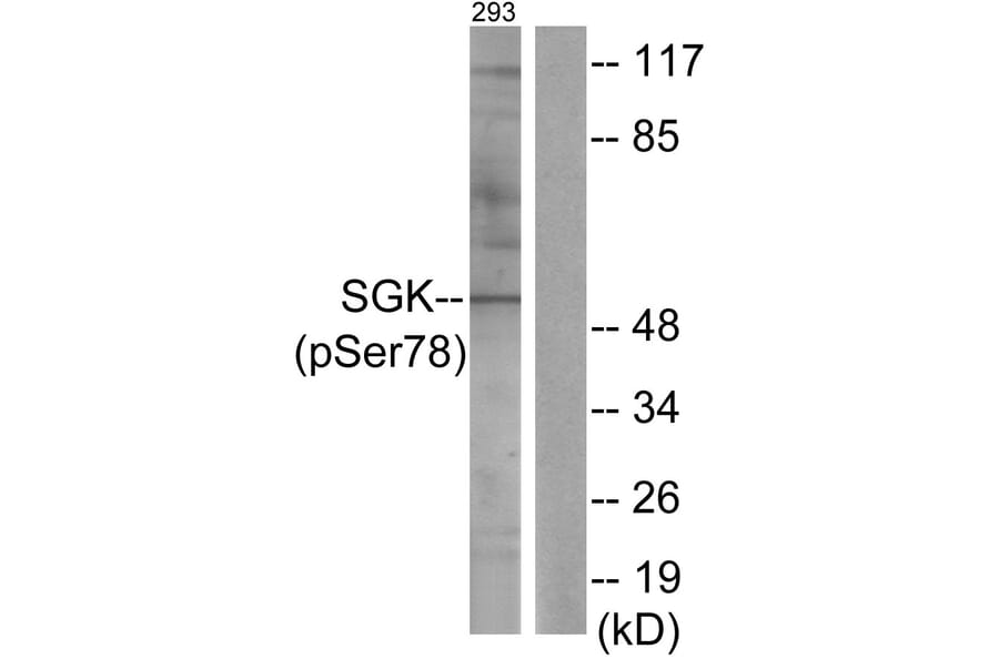 Western Blot - Anti-SGK (phospho Ser78) Antibody (A0735) - Antibodies.com