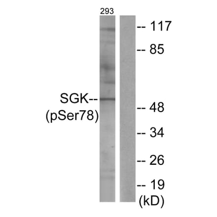 Western Blot - Anti-SGK (phospho Ser78) Antibody (A0735) - Antibodies.com