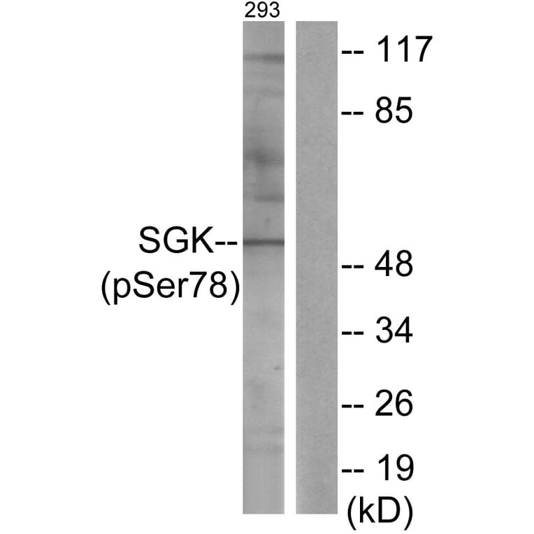 Western Blot - Anti-SGK (phospho Ser78) Antibody (A0735) - Antibodies.com