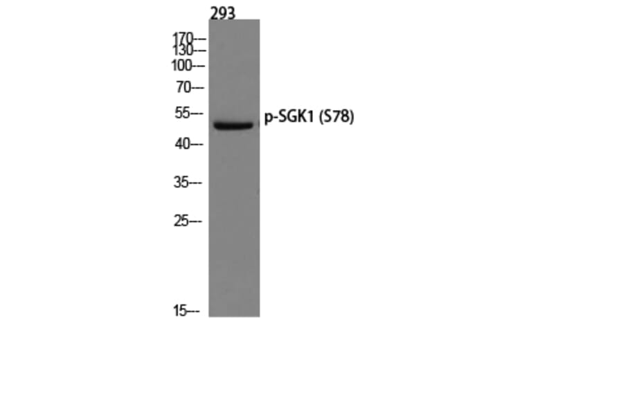 Western Blot - Anti-SGK (phospho Ser78) Antibody (A0735) - Antibodies.com