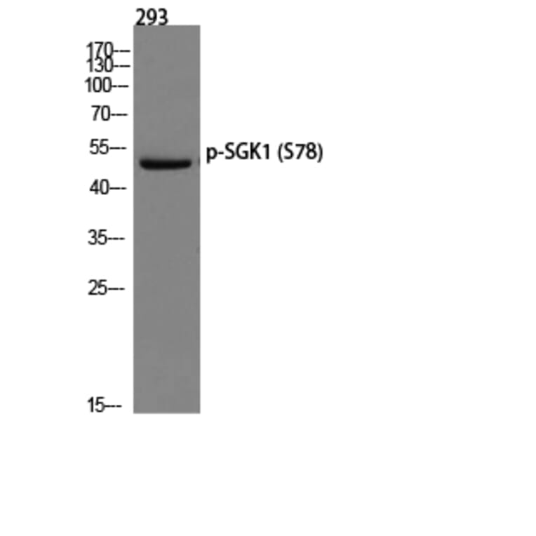 Western Blot - Anti-SGK (phospho Ser78) Antibody (A0735) - Antibodies.com