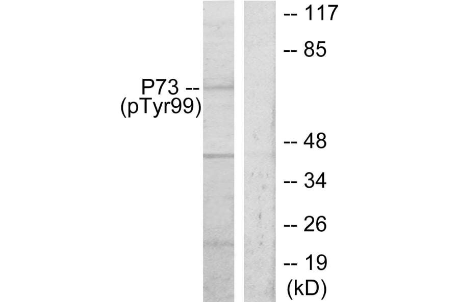 Western Blot - Anti-p73 (phospho Tyr99) Antibody (A7191) - Antibodies.com