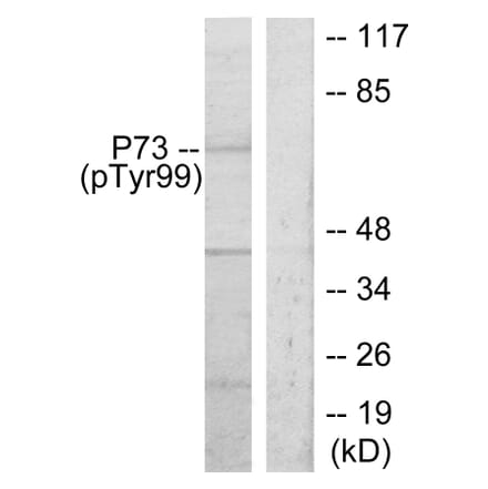 Western Blot - Anti-p73 (phospho Tyr99) Antibody (A7191) - Antibodies.com