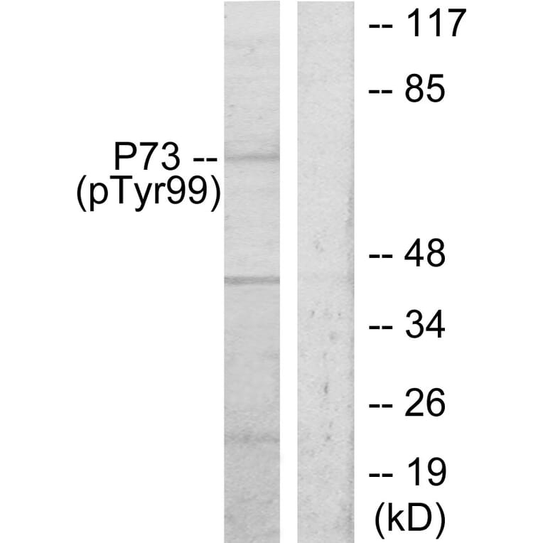 Western Blot - Anti-p73 (phospho Tyr99) Antibody (A7191) - Antibodies.com