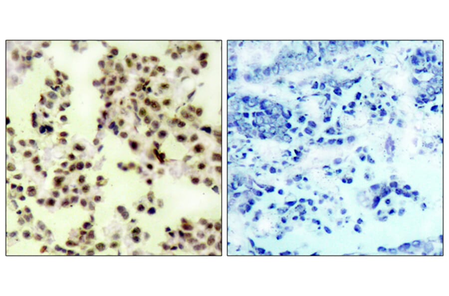 Immunohistochemistry - Anti-p73 (phospho Tyr99) Antibody (A7191) - Antibodies.com