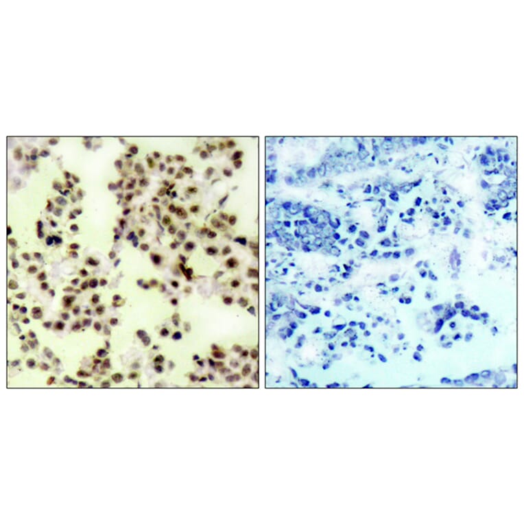 Immunohistochemistry - Anti-p73 (phospho Tyr99) Antibody (A7191) - Antibodies.com