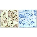 Immunohistochemistry - Anti-p73 (phospho Tyr99) Antibody (A7191) - Antibodies.com