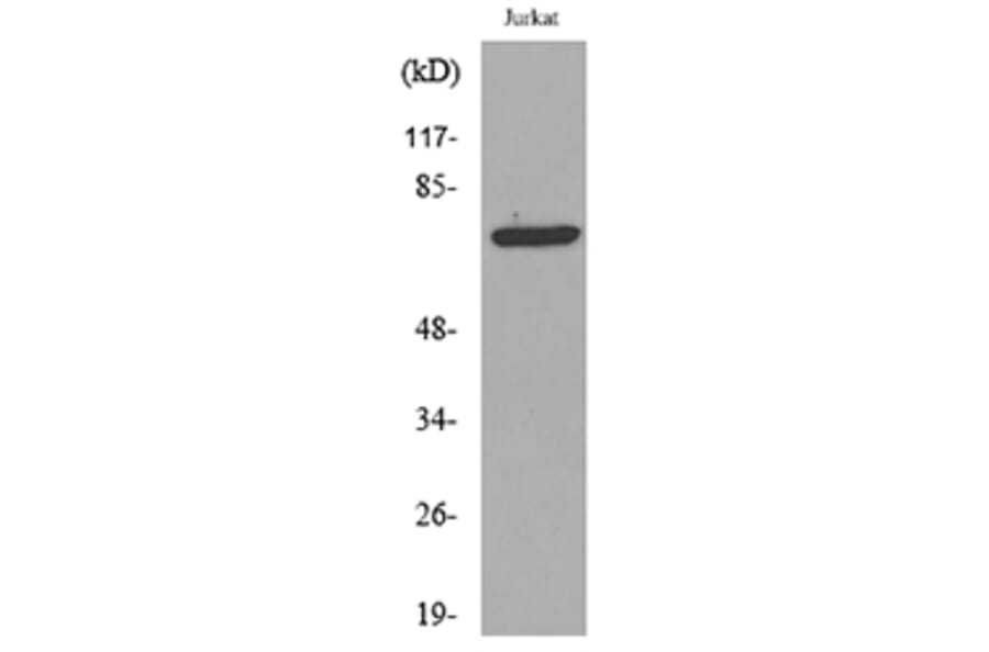 Western Blot - Anti-p73 (acetyl Lys327) Antibody (D12177) - Antibodies.com
