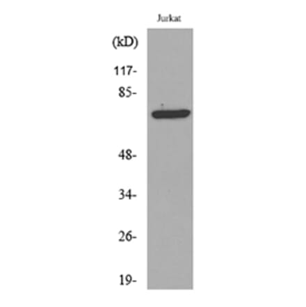 Western Blot - Anti-p73 (acetyl Lys327) Antibody (D12177) - Antibodies.com
