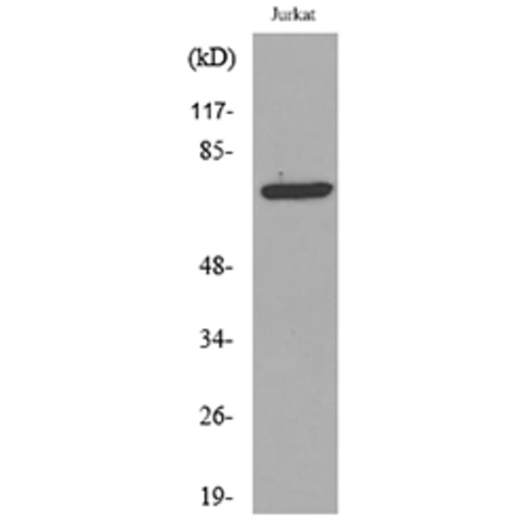 Western Blot - Anti-p73 (acetyl Lys327) Antibody (D12177) - Antibodies.com