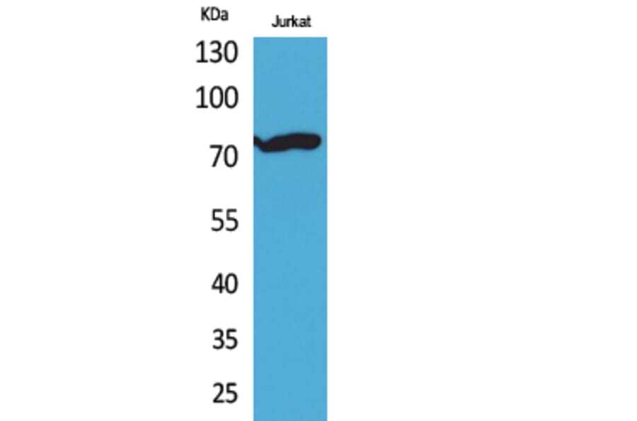 Western Blot - Anti-p73 (acetyl Lys327) Antibody (D12177) - Antibodies.com