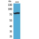 Western Blot - Anti-p73 (acetyl Lys327) Antibody (D12177) - Antibodies.com