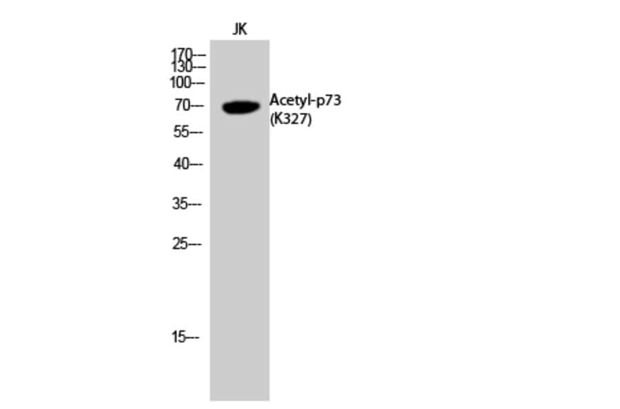 Western Blot - Anti-p73 (acetyl Lys327) Antibody (D12177) - Antibodies.com