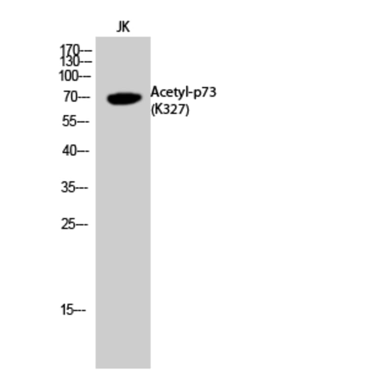 Western Blot - Anti-p73 (acetyl Lys327) Antibody (D12177) - Antibodies.com